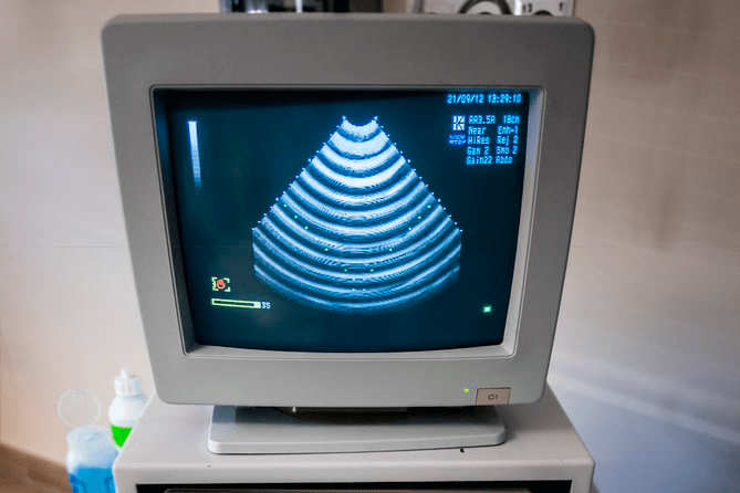 Monitor de ultrasonido mostrando imagen de ecografía